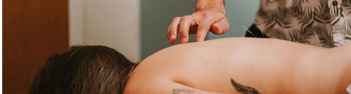 Acupuncture for Trigger Points — Morningside Acupuncture NYC