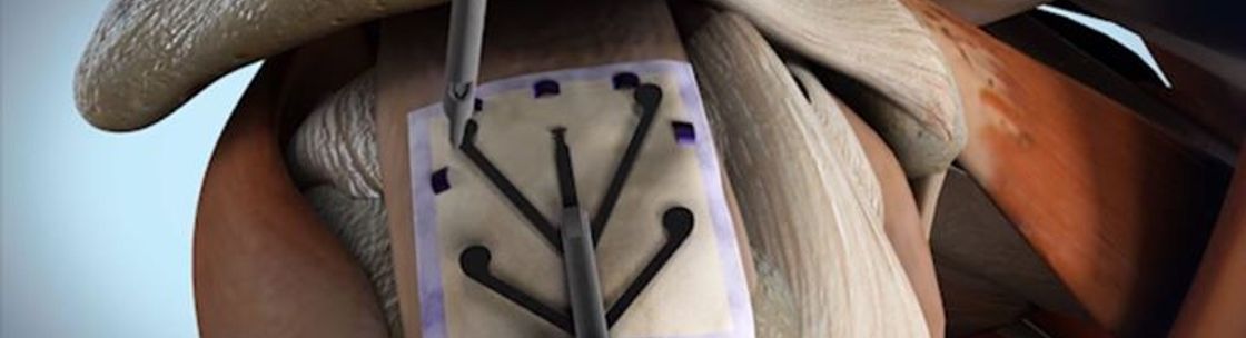 Rotation Medical, Plymouth MN