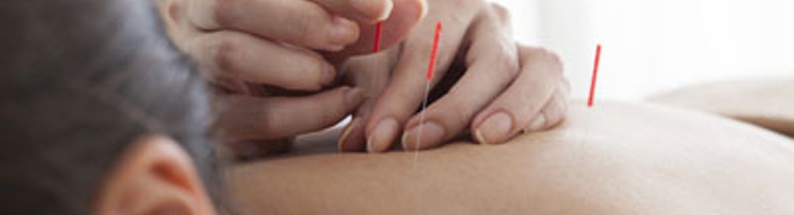 Acupuncture Center Inc, Poway CA