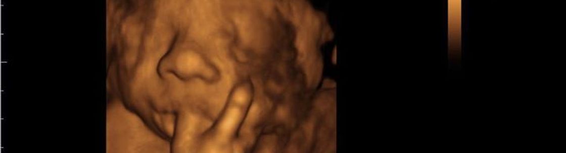 Sonographic Images Inc, Gary IN