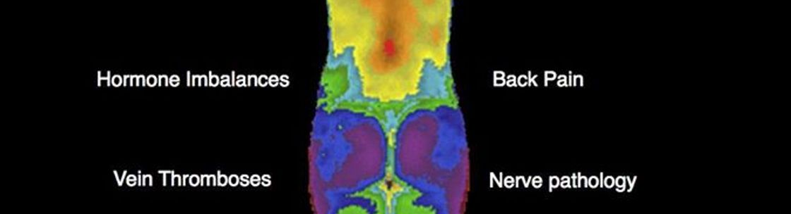 Medical Thermography of Atlanta, Atlanta GA