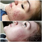 ProCell Micro Channeling/ExP realtor