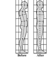 Structural Integrative Bodywork, commonly known as ROLFING - Alignable