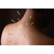 Calm Spirit Acupuncture and Massage