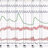 Apex Polygraph
