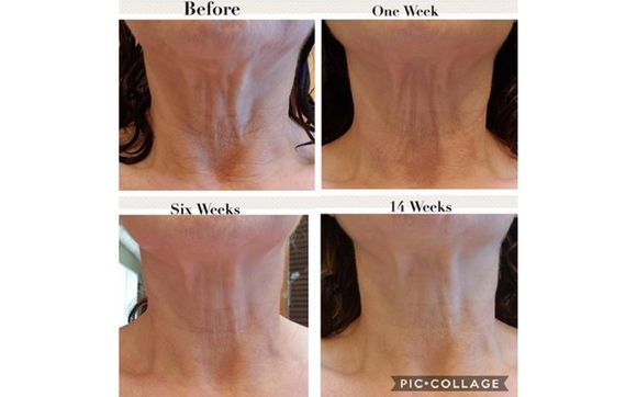 revision skincare nectifirm advanced