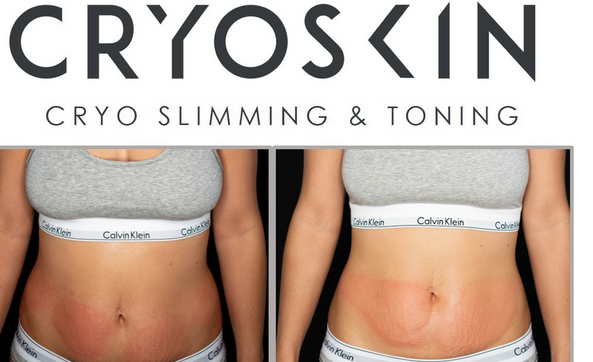 Fall special -  5 slimming or Toning treatments $700 with Jen Gallagher LE