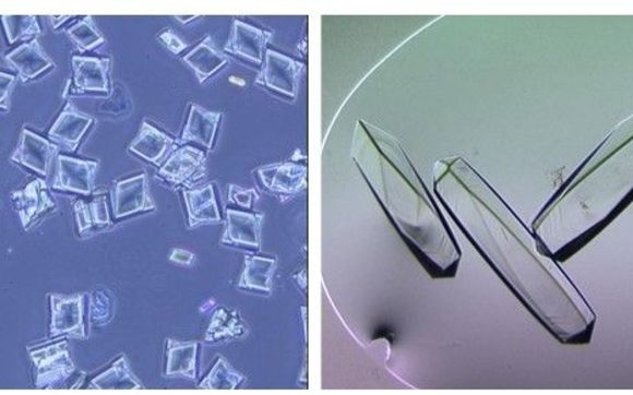Crystals for high protein concentration formulations by Procrysta Biologix