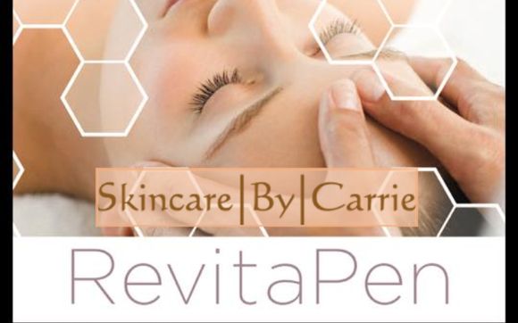 RevitaPen Nano Infusion Anti Aging Facial by Skincare By Carrie