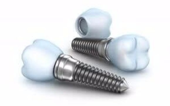 Dental Implant Dentisty by Paris Family Dental