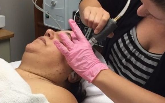Microdermabrasion by Education Tree of Cosmetology, LLC