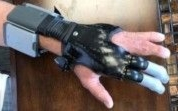 I-LIMB QUANTUM by Precision Prosthetics & Orthotics, LLC in Casper, WY ...
