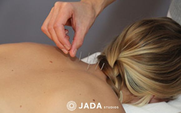 Acupuncture by JADA Studios