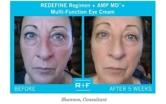 AMP MD System and Intensive Renewing Serum by Rodan+Fields in