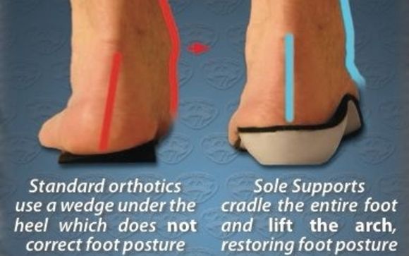 Custom Foot Orthotics by Superior Foot Supports LLC in Midlothian VA Alignable