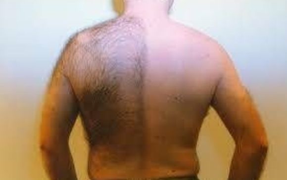 Laser Hair Removal by Tat 2 Undo