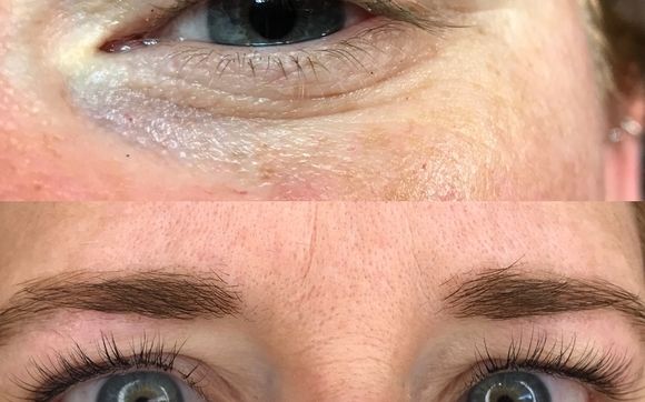 Lash lift by Renew Salon and Spa