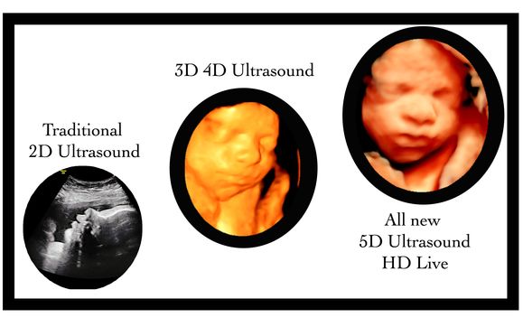 2d 3d 4d 5d Baby Ultrasounds By A Baby Visit 3d 4d