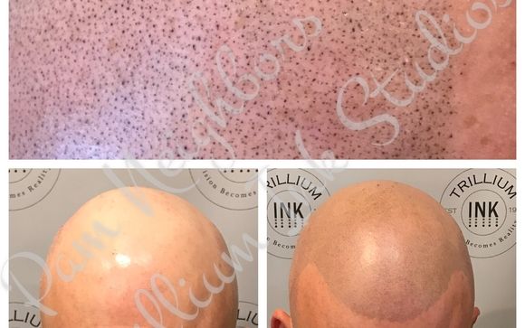 Scalp Micropigmentation by Trillium Ink Studios