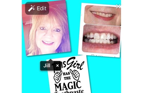 I Offer Whiter Teeth By Nuskin In Jackson Tn Alignable