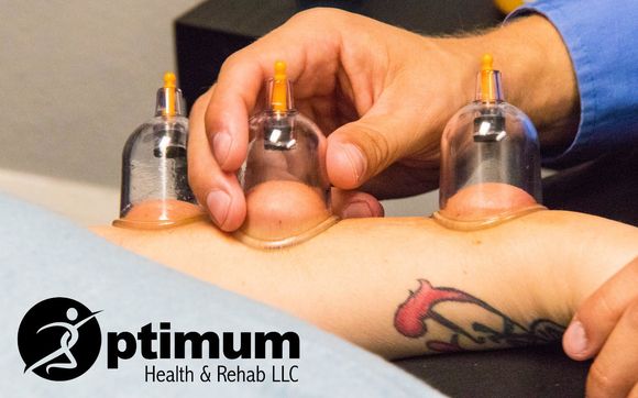 Cupping Therapy by Optimum Health & Rehab LLC