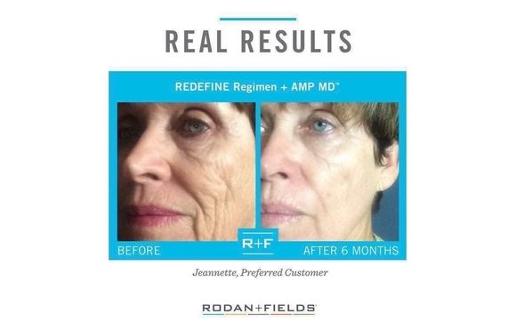 Redefine Regimen by Rodan+Fields Skin Care Consultant 