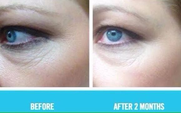 rodan fields eye cream
