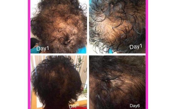 Nrf2 Haircare System By Less Aging More Life In Puyallup Wa