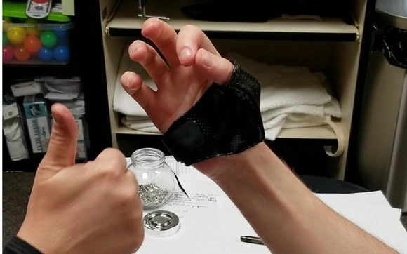 Custom Splinting on site by Advanced Health Physiotherapy in Edmonton ...