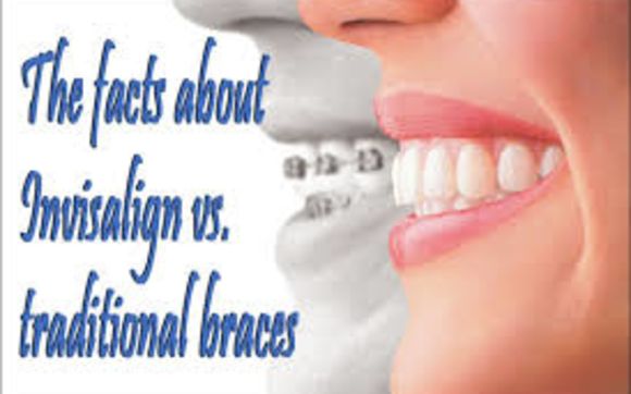 Braces and Invisalign by Beacon Orthodontic Associates: Dr. Shari Lisann