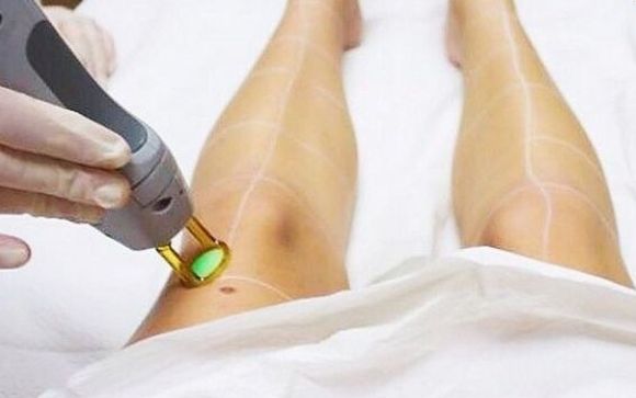 Laser Hair Removal by Shore Integrative Medicine Wellness Center