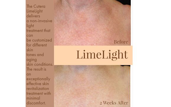 LimeLight by Impressions Skin Solutions in Hendersonville, TN ...