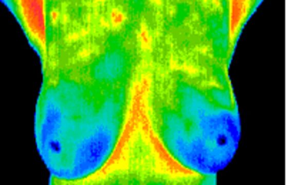Breast Thermography by Mindful Solutions Healing Alternatives
