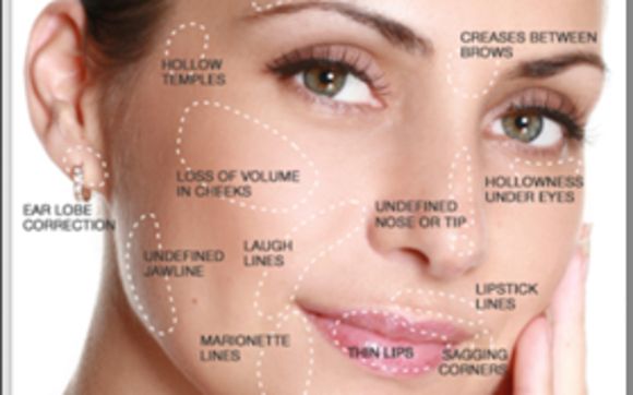 Dermal Fillers by Patient Preferred Dermatology Medical Group, Inc.