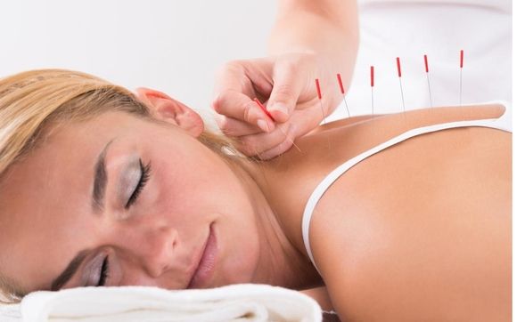 Acupuncture by Meridian Acupuncture and Wellness Center