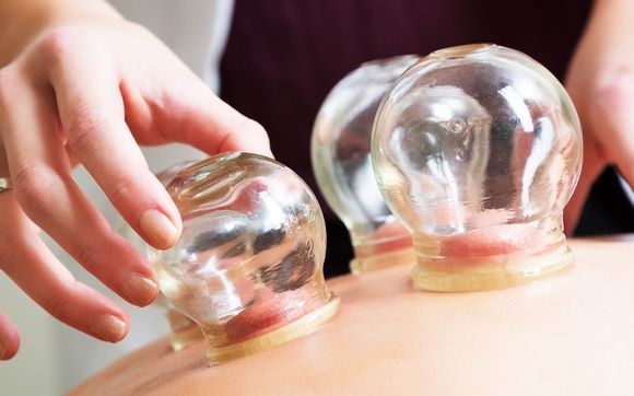 Cupping by Meridian Acupuncture and Wellness Center