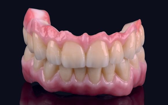 Prettau Zirconia Crowns by JU Genesis LAB | JU Dental LAB 