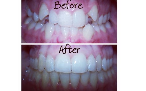 Orthodontics by Master Orthodontics and Facial Esthetics