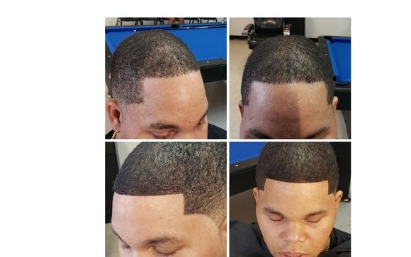 Hairline Replacement System By Sharp Cuts Barber Beauty In