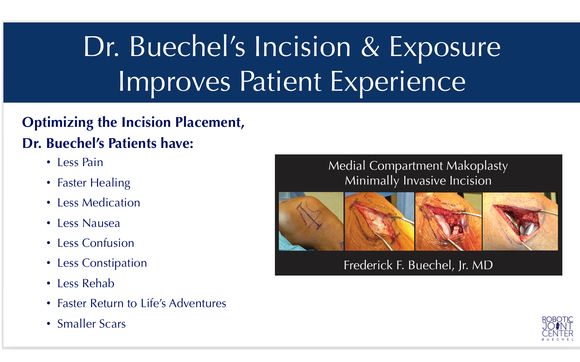 Medial Partial Knee Replacement Minimally Invasive Mini Incision