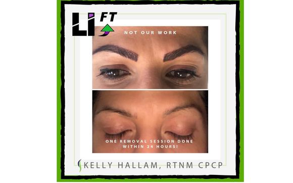Permanent Makeup Correction and Removal by Halcyon Cosmetic &  Skin Clinic
