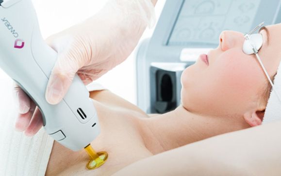 Laser Hair Removal By Zen Zone Spa In Boston Ma Alignable