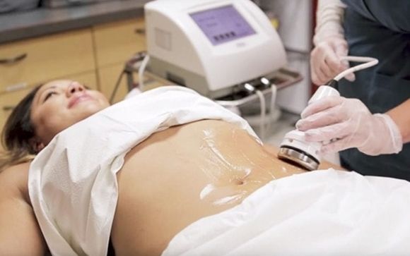 Laser Lipo by VENUS Body Sculpting in Las Vegas, NV - Alignable