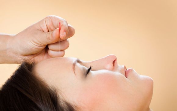 Cosmetic Acupuncture by Jupiter Acupuncture - Dr. Shams Tara Wesley