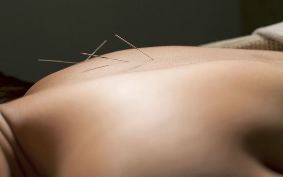 Acupuncture by Birchwood Acupuncture