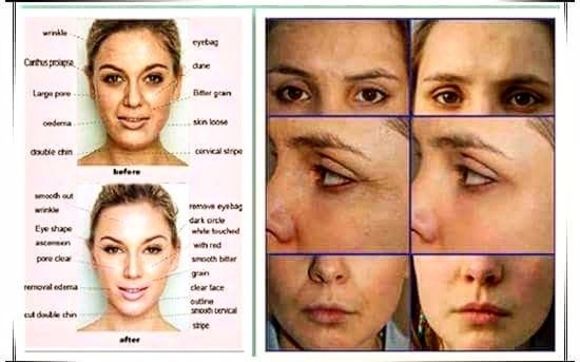 Hydrafacial  by LE BIJOU SALON DAYSPA