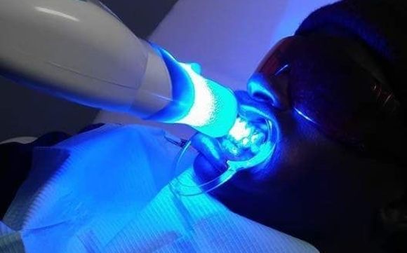 Laser Teeth Whitening by Whiter Smiles RVA Inc.