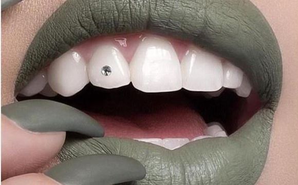 Tooth Gems by Whiter Smiles RVA Inc.