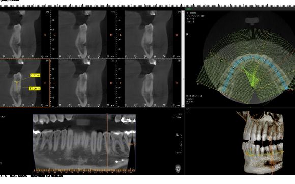 Latest Technology Digital X-rays & Dental CT Scans by Dr. Armen Mardirossian Periodontics