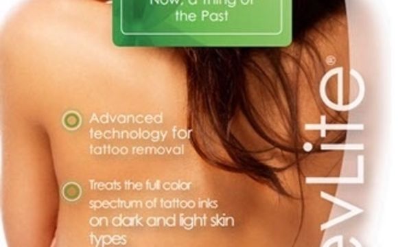 LASER TATTOO REMOVAL by Sage Laser Tattoo Removal